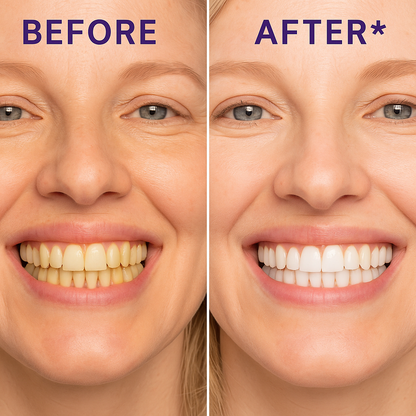 Lumera Whitening Strips